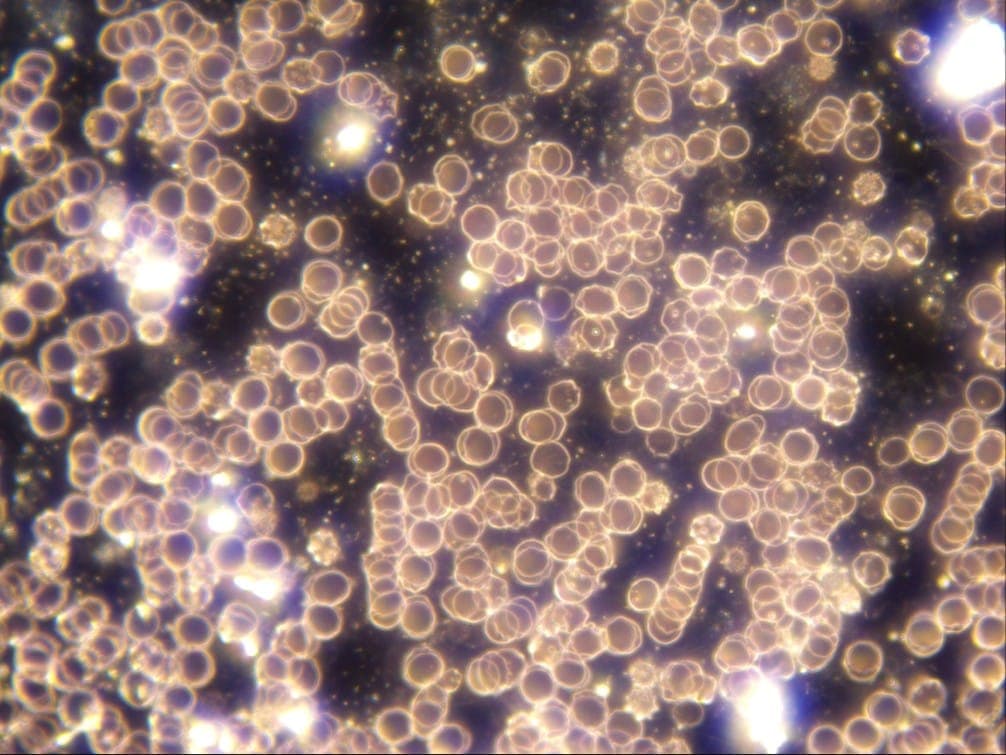 Microscopic view of glowing circular cells